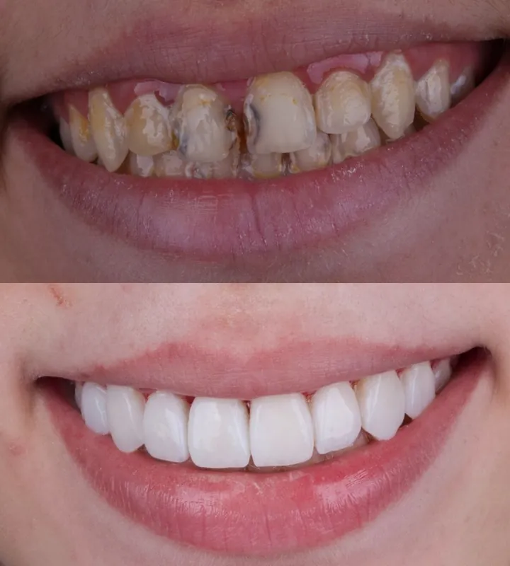 Antes e depois — caso 7